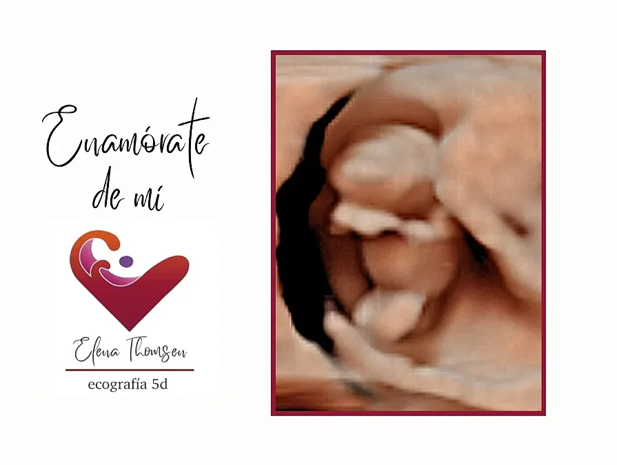 ecografias 5d